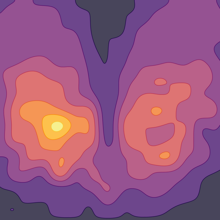 An interface pressure contour map of the buttocks.